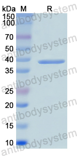 Recombinant Human GRN Protein, N-His