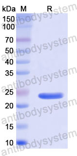 Recombinant Human LAP3 Protein, N-His