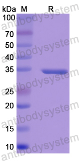 Recombinant Human HSD11B1 Protein, N-His