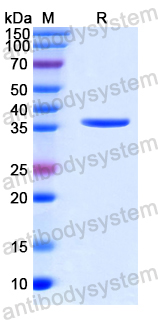 Recombinant Human CD38 Protein, N-His