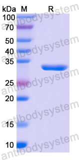 Recombinant Human CD1b Protein, N-His