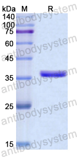 Recombinant Human S100A2 Protein, N-GST