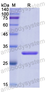 Recombinant Human PCSK1 Protein, N-His