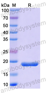 Recombinant Human CRABP2 Protein, N-His