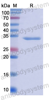 Recombinant Human TKT Protein, N-His