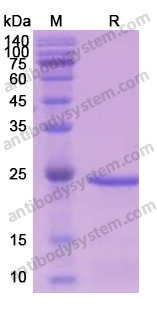 Recombinant Human CASP1/Caspase-1 Protein, N-His