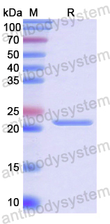 Recombinant Human NOS3 Protein, N-His