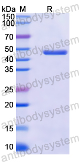 Recombinant Human NOS3 Protein, N-His
