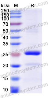 Recombinant Human NOS1 Protein, N-His