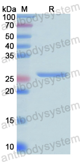 Recombinant Human SERPINB3 Protein, N-His