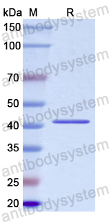 Recombinant Human PML Protein, N-His