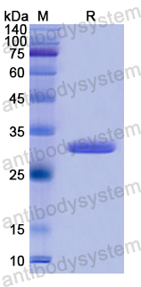 Recombinant Human TYK2 Protein, N-His