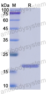 Recombinant Human CRABP1 Protein, N-His