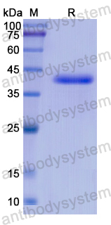 Recombinant Human GNA11 Protein, N-His