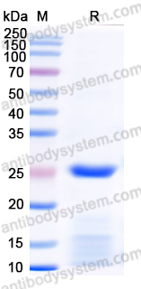 Recombinant Human BLVRB Protein, N-His