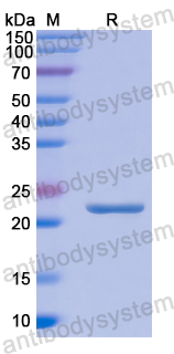 Recombinant Human PEBP1 Protein, N-His