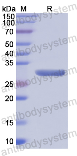 Recombinant Human PDIA3 Protein, N-His