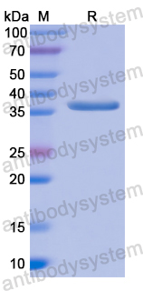 Recombinant Human CD6 Protein, N-His