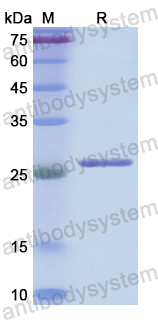 Recombinant Human CDC27 Protein, N-His