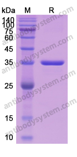 Recombinant Human CCND2 Protein, N-His