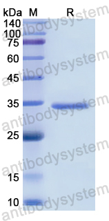 Recombinant Human CCND3 Protein, N-His