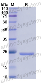 Recombinant Human CDC25B Protein, N-His