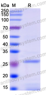 Recombinant Human CDC25C Protein, N-His