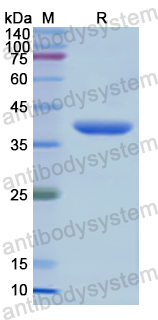 Recombinant Human AXL/UFO Protein, N-His-SUMO