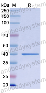 Recombinant Human LRPAP1 Protein, N-His