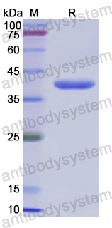 Recombinant Human GRPR Protein, N-GST