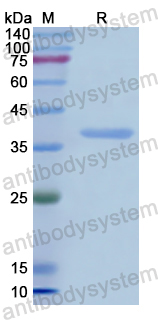 Recombinant Human OXTR Protein, N-GST