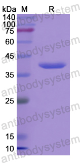 Recombinant Human ADSL Protein, N-His