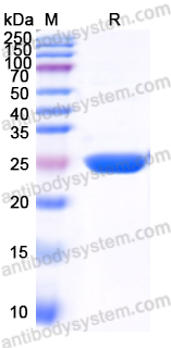 Recombinant Human GSTT1 Protein, N-His