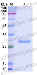 Recombinant Human SERPINB1 Protein, N-His