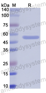 Recombinant Human ALDH1B1 Protein, N-His