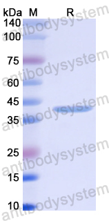 Recombinant Human GNRHR Protein, N-GST