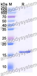 Recombinant Human CALCR/Calcitonin receptor/CT-R Protein, N-His