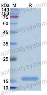 Recombinant Human NTS Protein, N-His