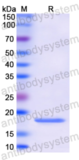 Recombinant Human LCN1 Protein, N-His