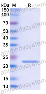 Recombinant Human CORO1A Protein, N-His