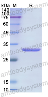 Recombinant Human GDI1 Protein, N-His