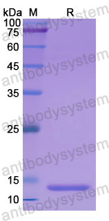 Recombinant Human S100A7 Protein, N-His