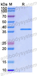 Recombinant Human MAPK4 Protein, N-His