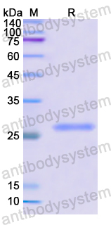 Recombinant Human MAT2A Protein, N-His