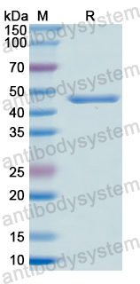 Recombinant Human SRD5A2 Protein, N-GST