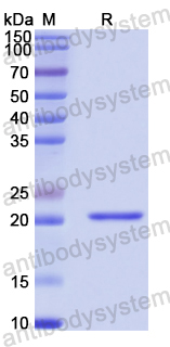 Recombinant Human HOXA10 Protein, N-His-SUMO