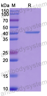 Recombinant Human CASQ1 Protein, N-His