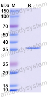 Recombinant Human TIA1 Protein, N-GST & C-His