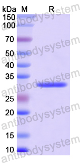 Recombinant Human FMO3 Protein, N-His