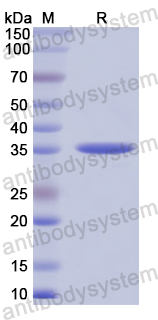 Recombinant Human SLC6A4 Protein, N-GST